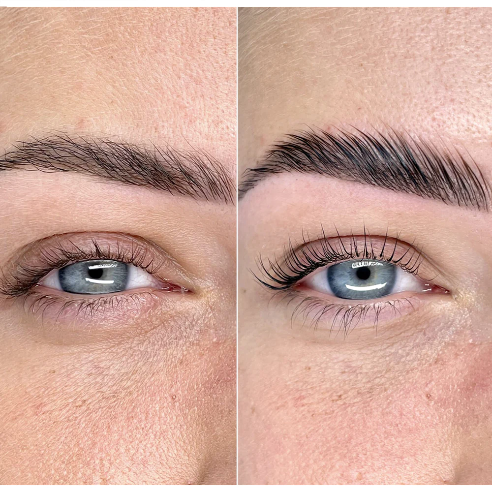 Brow Megapack
