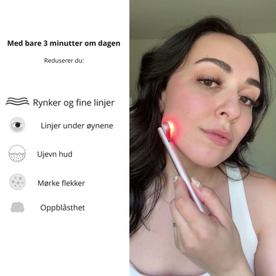 SkinPro 2.0 – 4-i-1 hudpleiestav med rødt lysterapi (+Gratis serum)