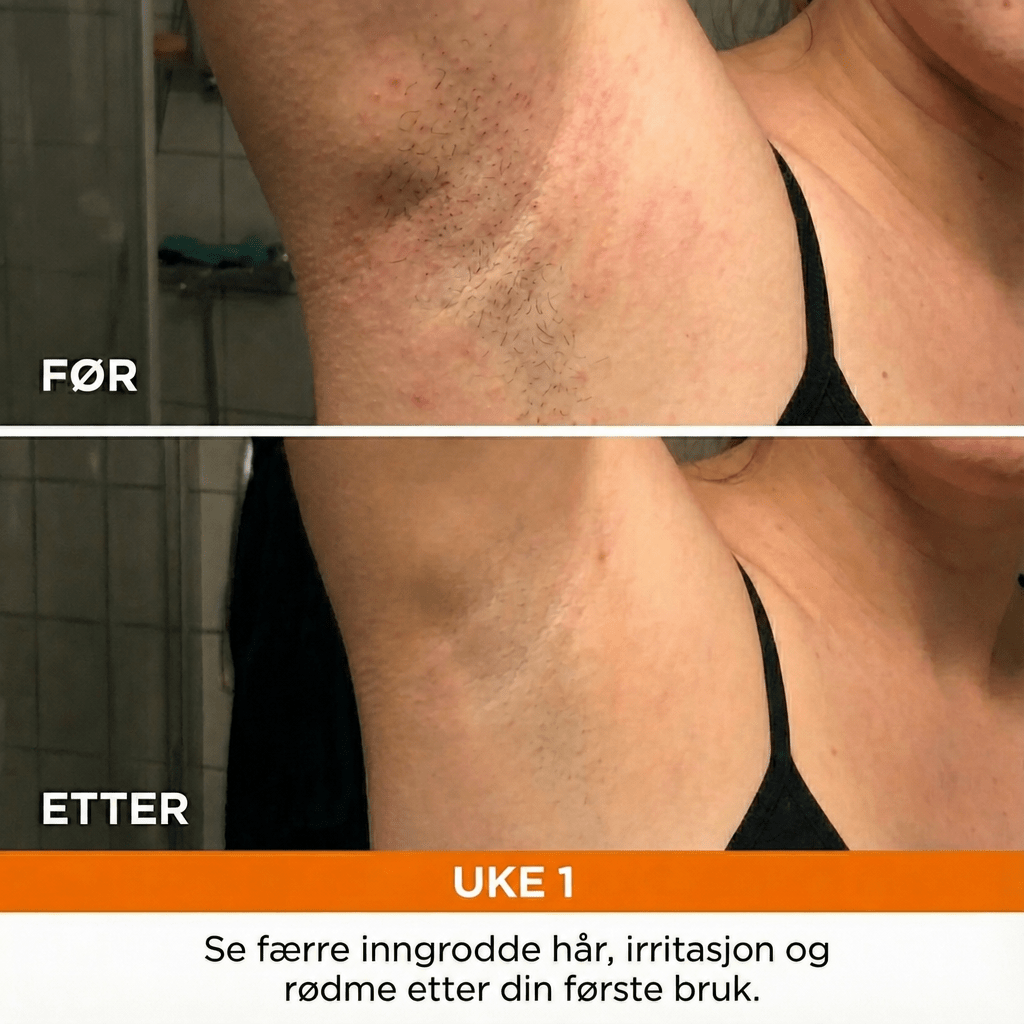 Anti - hårvekst serum - AVABeauty.no