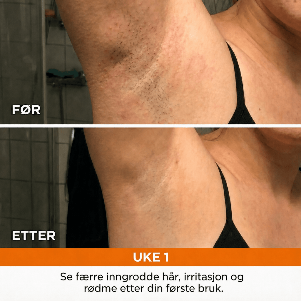 Anti-hårvekst serum - AVABeauty.no